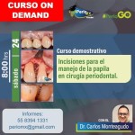 Incisiones para el manejo de la papila en cirugia periodontal $USD 